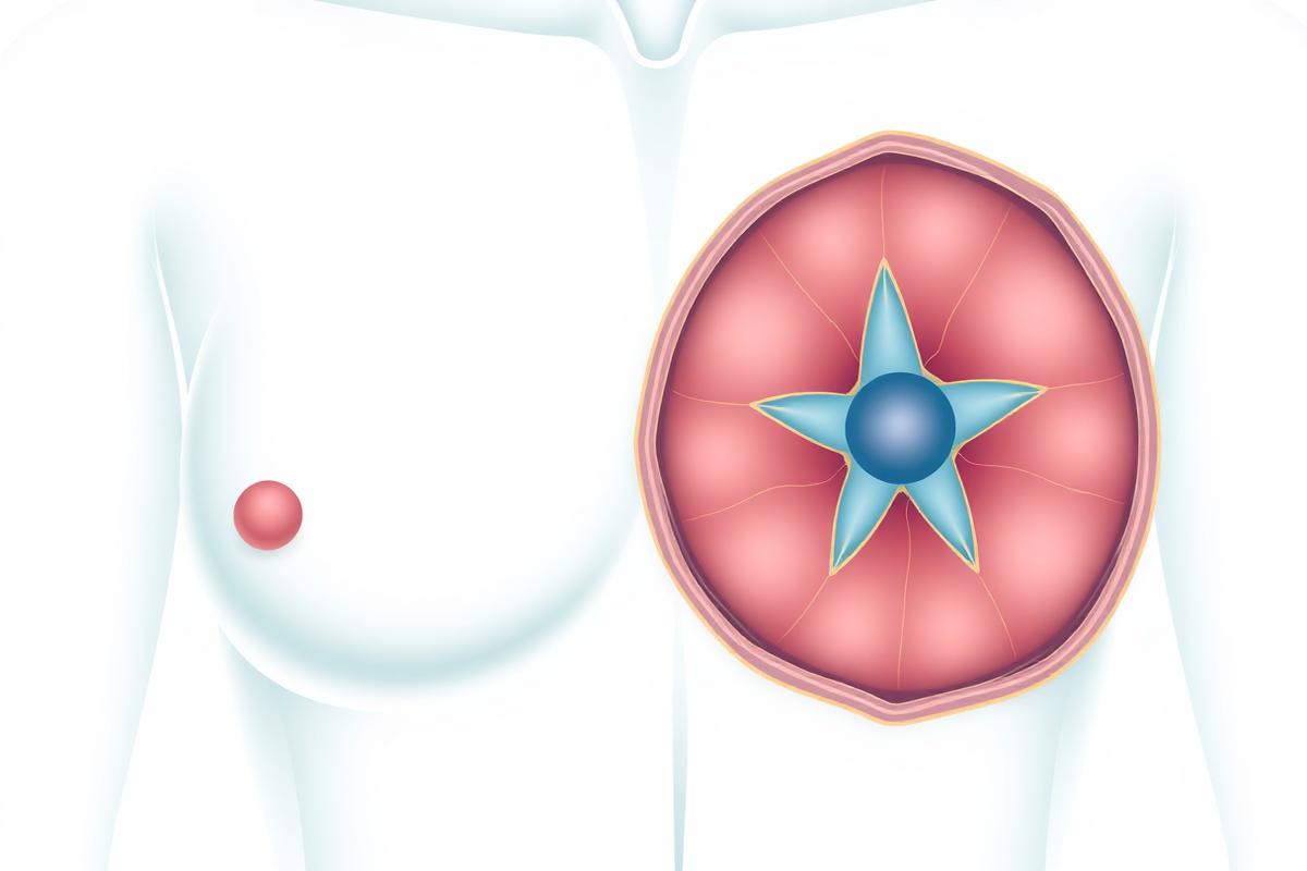 Breast Cancer Breast cancer care — female breast anatomy medical illustration